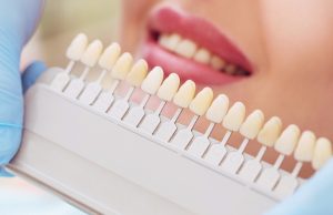 wybielanie zębów toruń - esthetic dental clinic